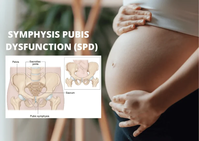 SPD (Symphysis Pubis Dysfunction) aliyas SAKIT DI TULANG KEMALUAN saat HAMIL